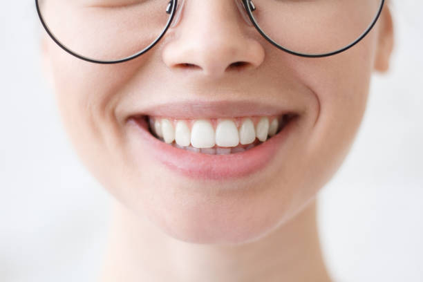 Up close photo of a woman's smile.