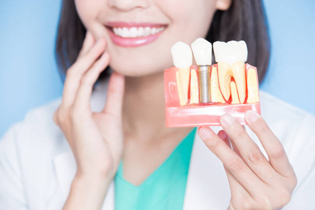 A dental professional holding up a model of a dental implant.