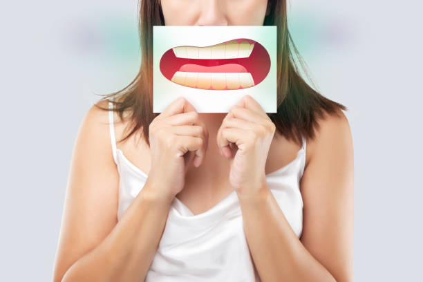 Woman holding up a cartoon picture of an open mouth with discolored teeth in front of her face.